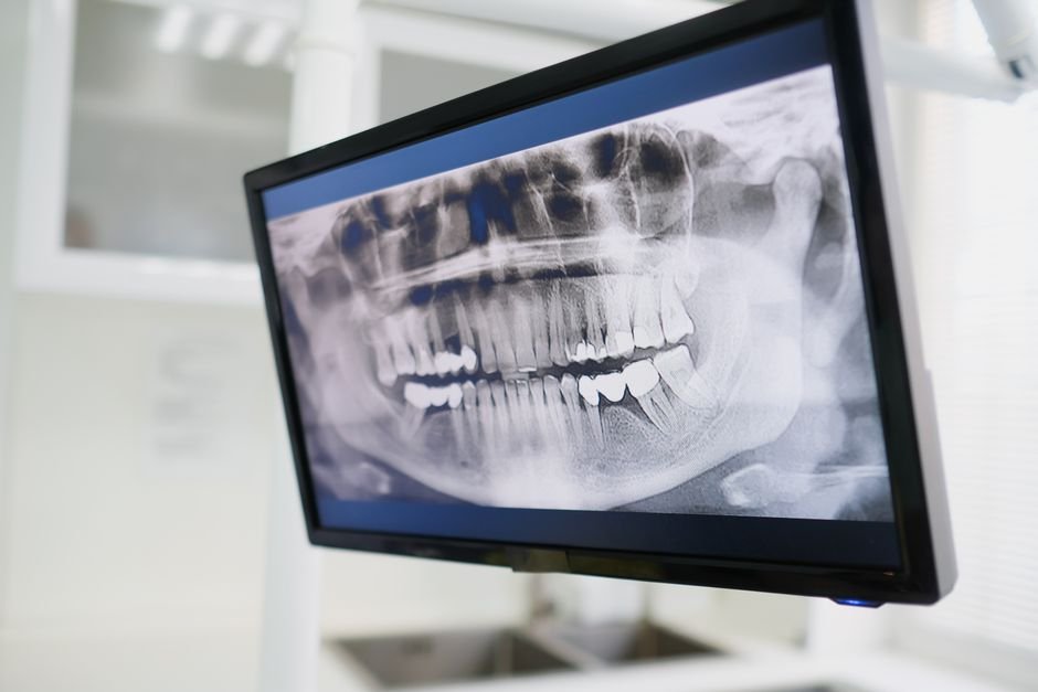 dental malpractice lawyer